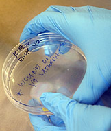 Cancer research in Coller lab