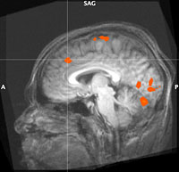 Sr Thesis Thornton brain