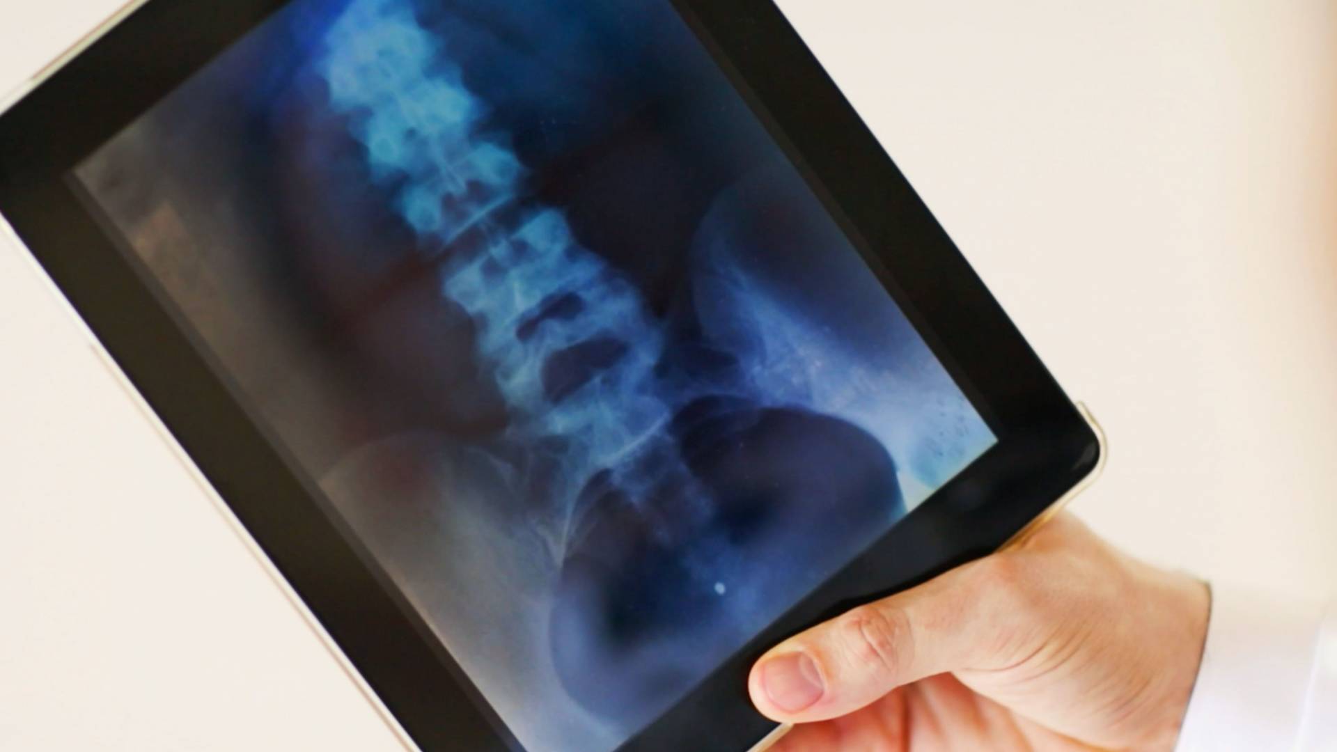 hand holding Xray of spine and pelvis