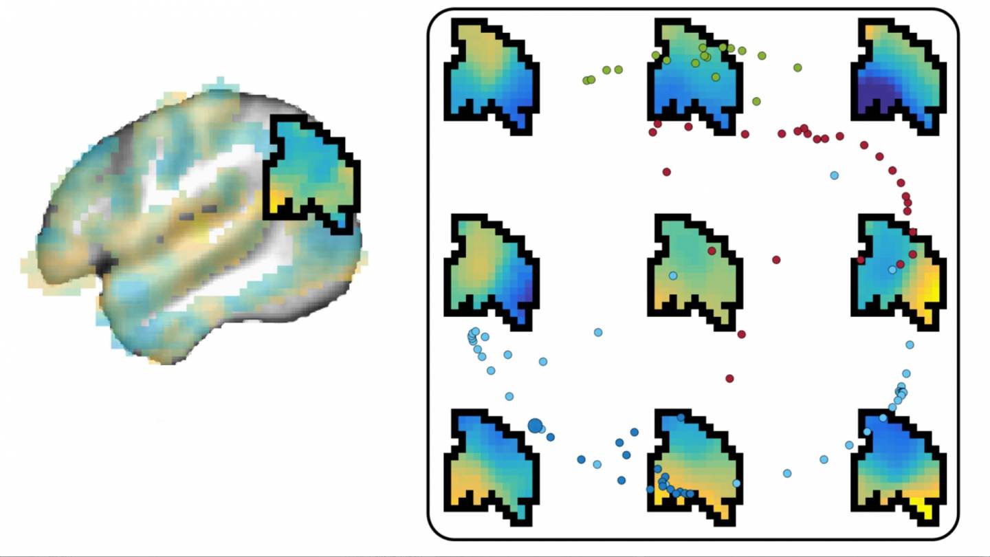 Simulation of brain activity
