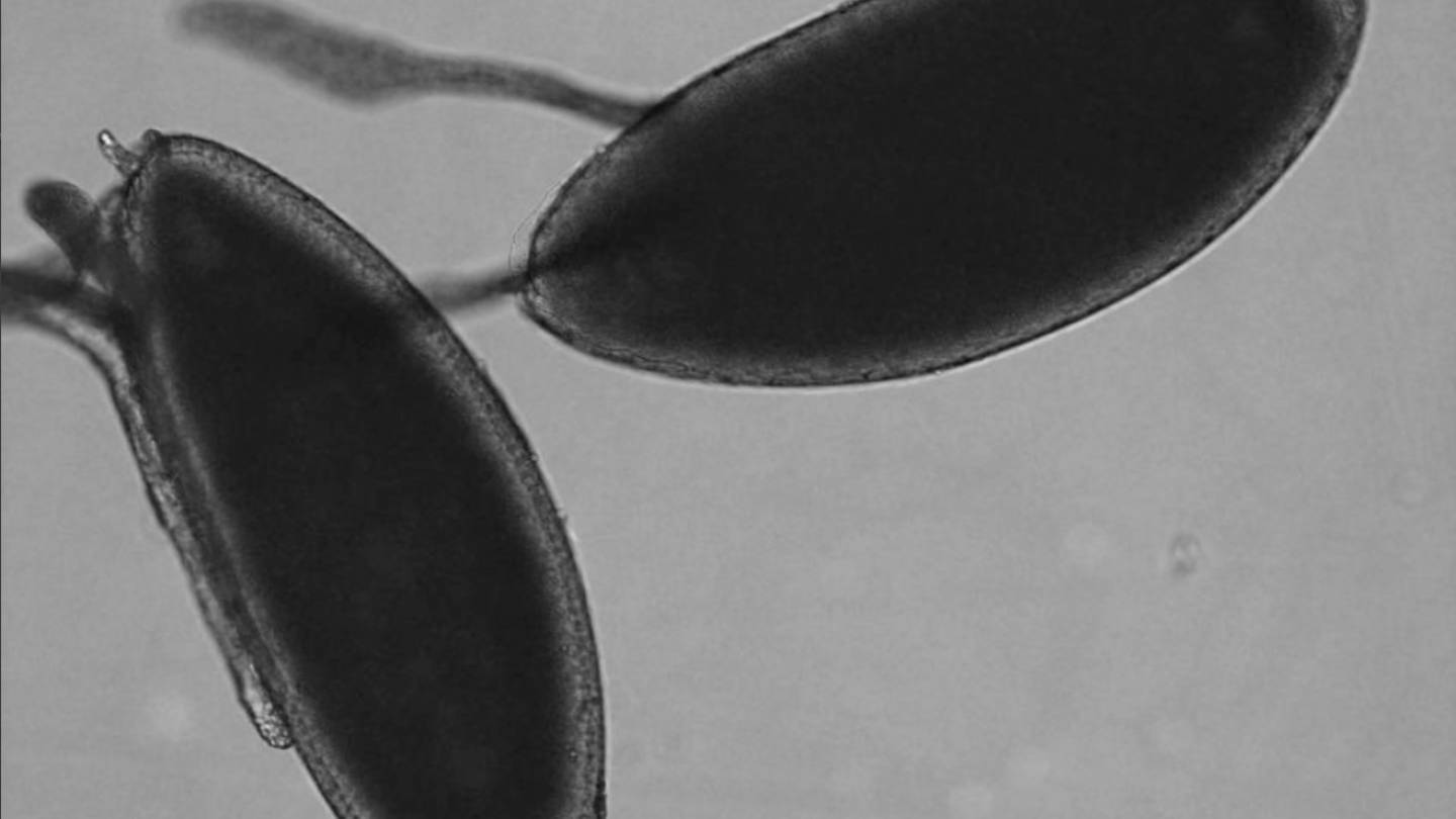 Fruit fly egg development