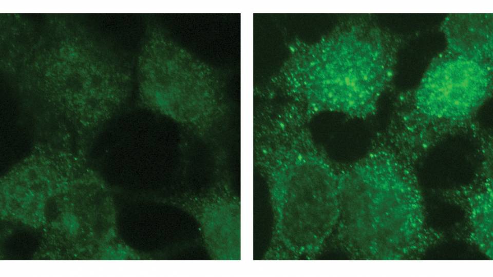 Visualization of gene activity