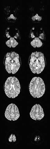 Series of scanner images