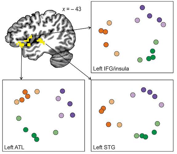 Neuro release fig 14
