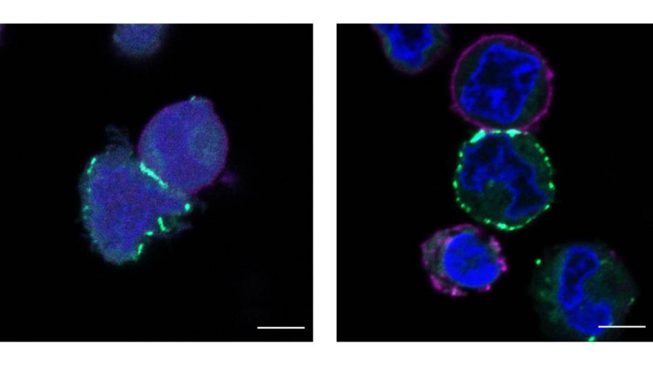 Micromap imaginging paints nearby cells a fluorescent green.