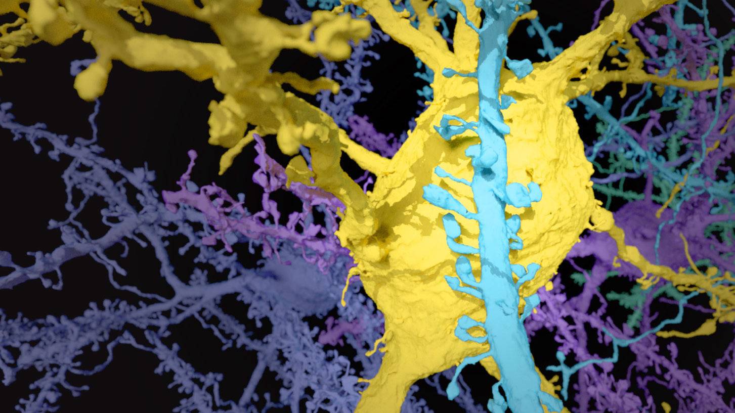 Soma and Spiny Dendrite Sterling