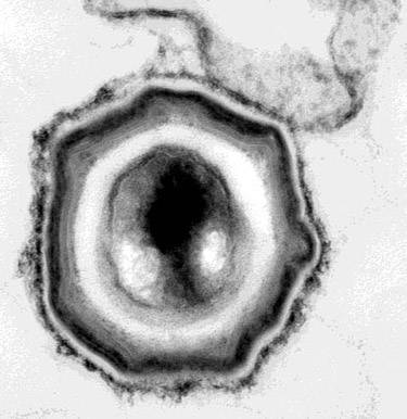 bacterium spore