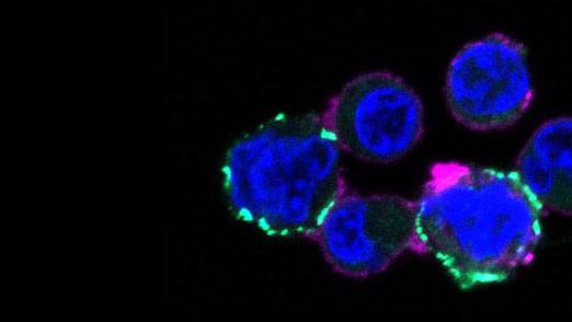 colored shapes as seen in microscopy