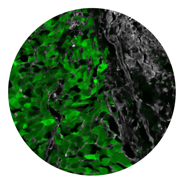 Green speckles intermix with black speckles in a round circle.